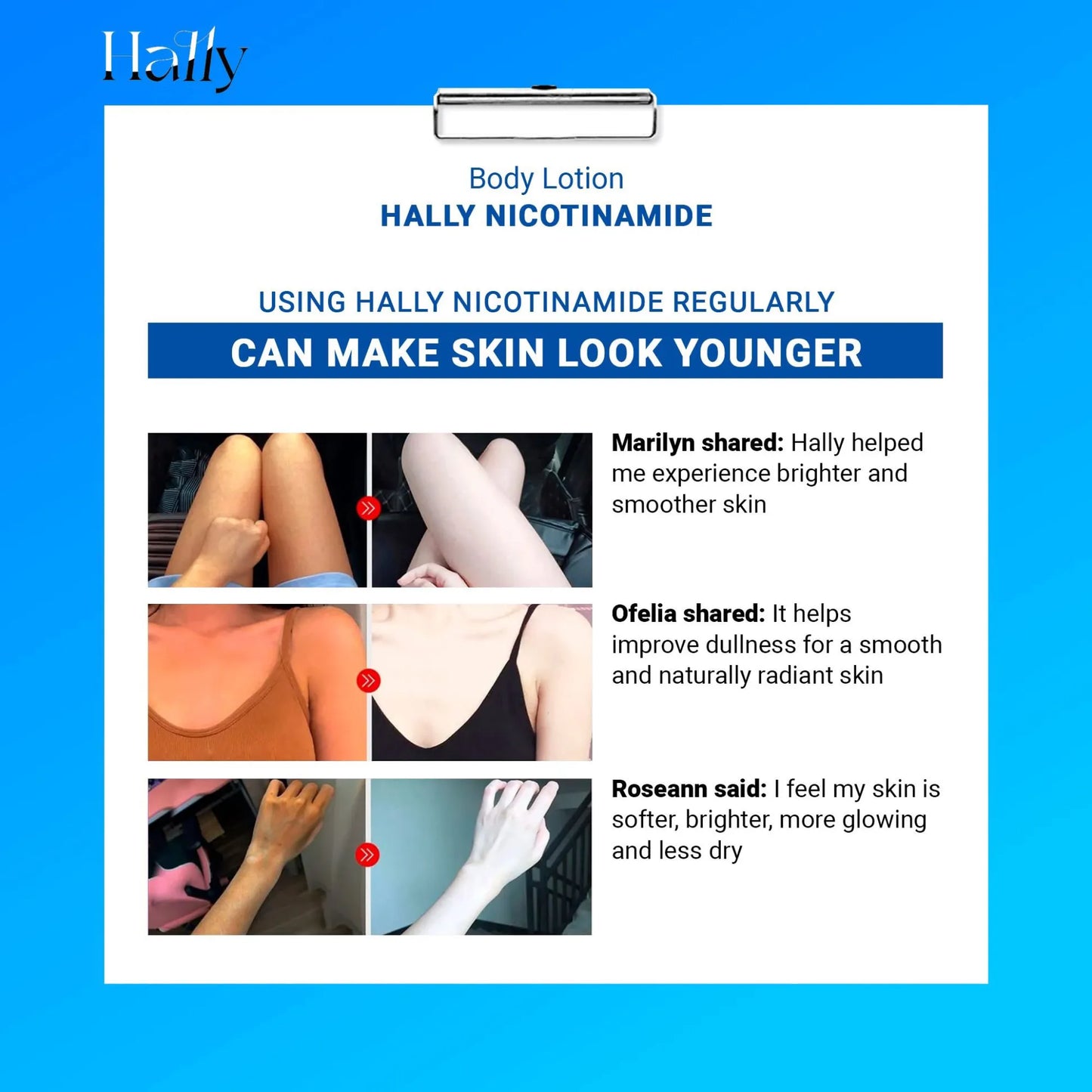 Original Hally Niacinamide Whitening Body Lotion
