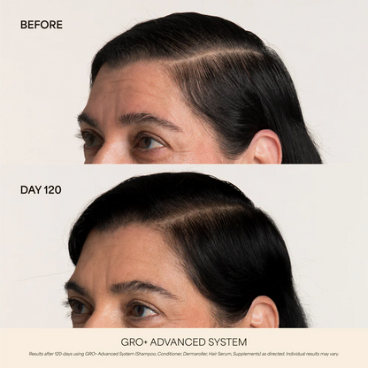 Hair Growth & Longevity Kit