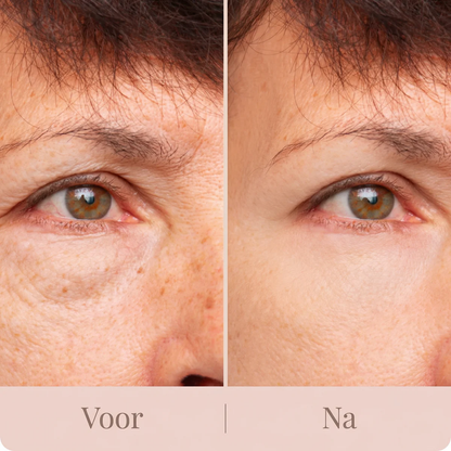 The Peptide Collagen Hydrogel Eye Patch (60 patches) | DEPUFFS UNDER-EYE BAGS IN JUST 10 MINUTES