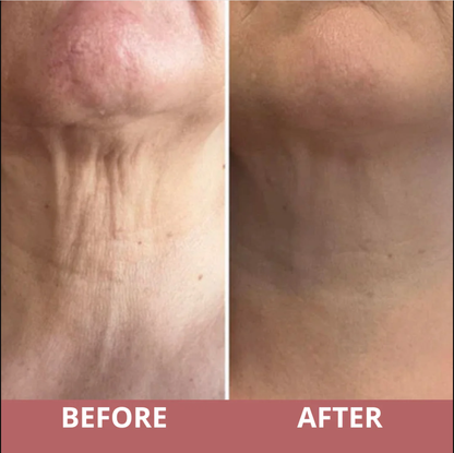 TIGHTEN & LIFT NECK CREAM by CocoBeauty