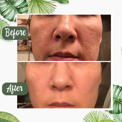MatchaGlow™ – Clarifying Face Mask